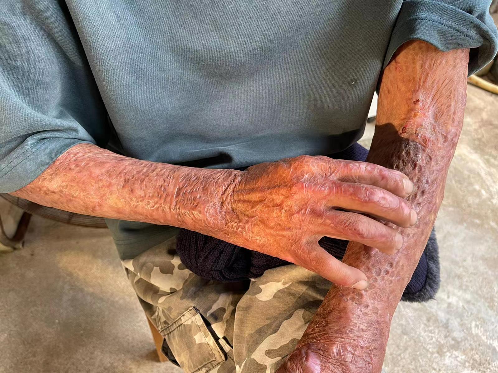 惹火烧身(惹火烧身引火烧身)