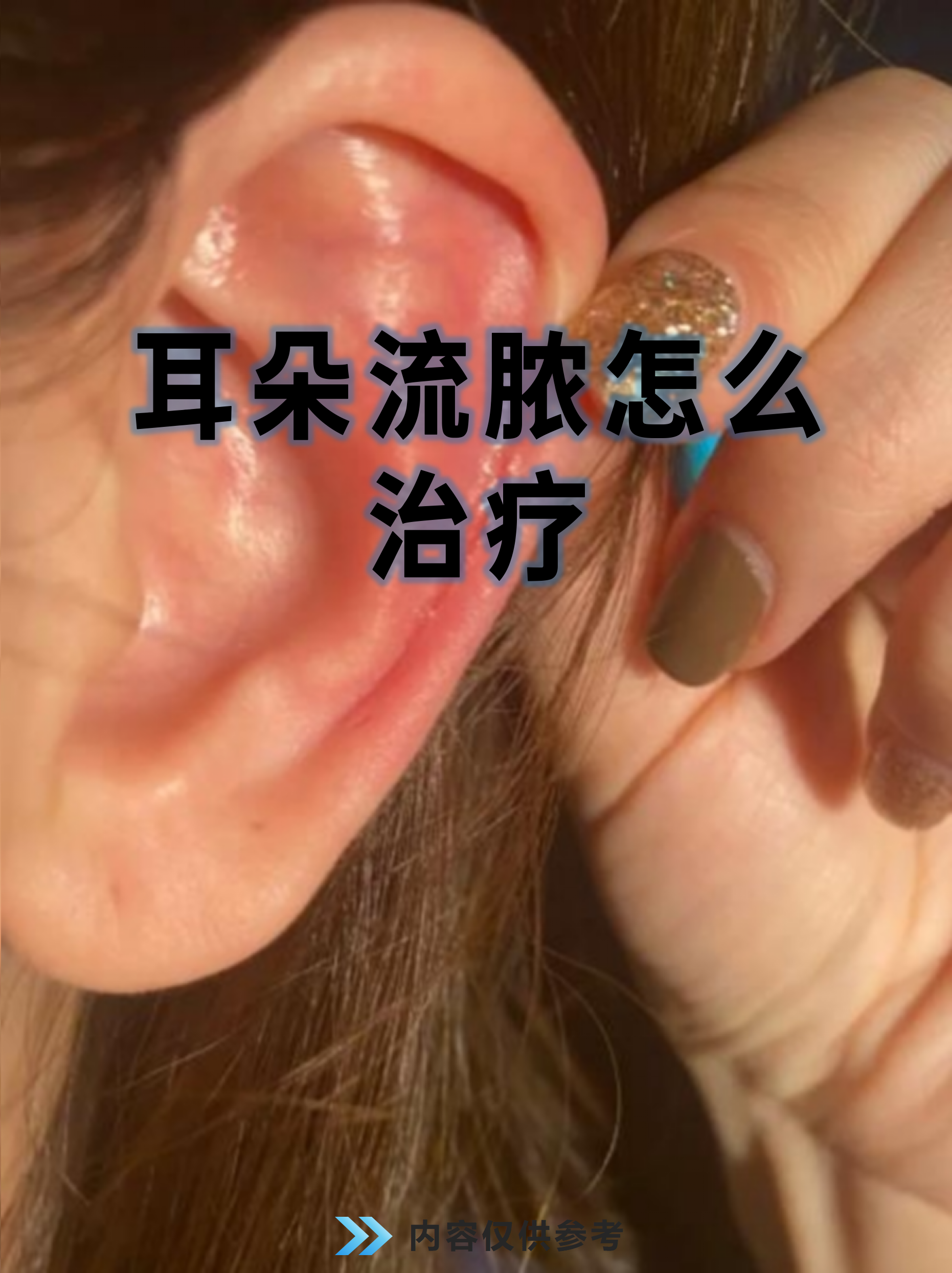 猫咪耳朵发炎流脓了怎么办(猫咪耳朵发炎流脓了怎么办啊)