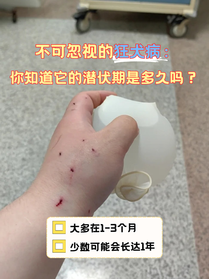 猫爪子上有狂犬病毒么(猫爪子上有狂犬病毒的概率) 猫爪子上有狂犬病毒么(猫爪子上有狂犬病毒的概率)