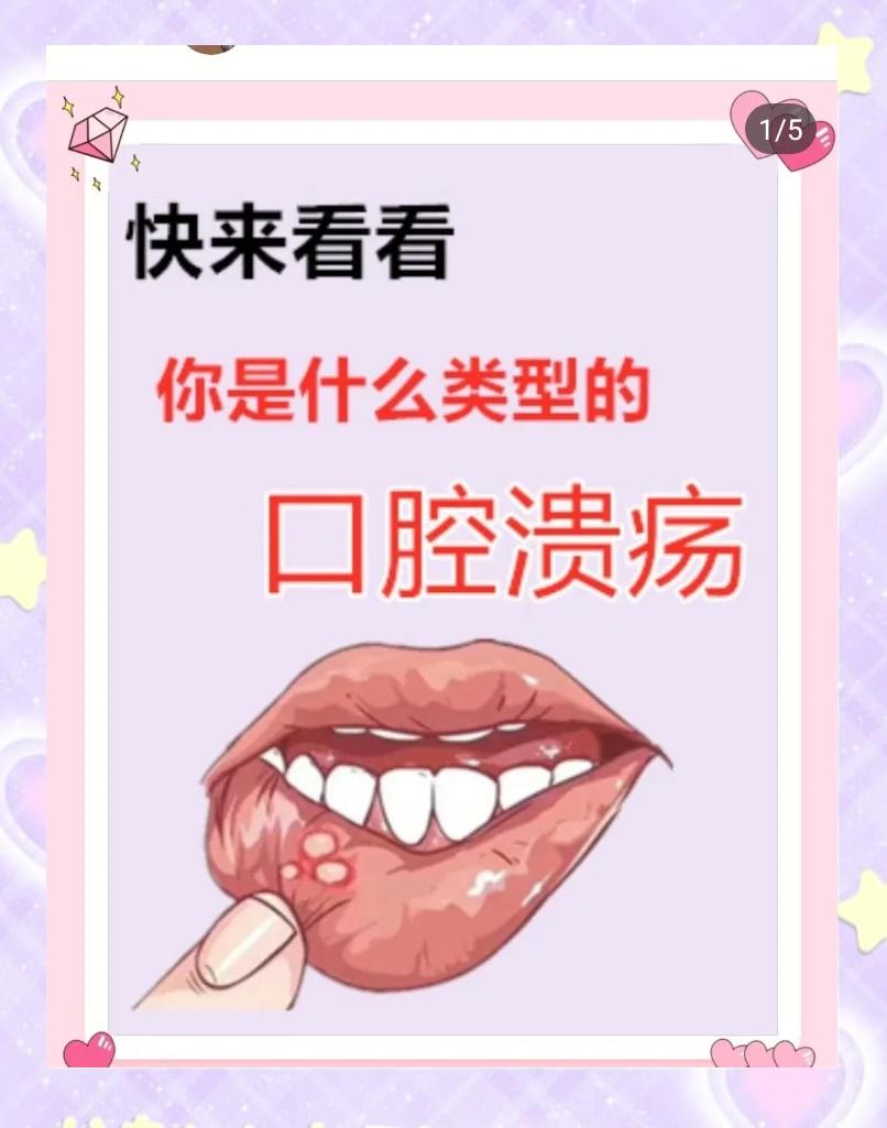 长期口腔溃疡怎么治(常年口腔溃疡怎么根治)
