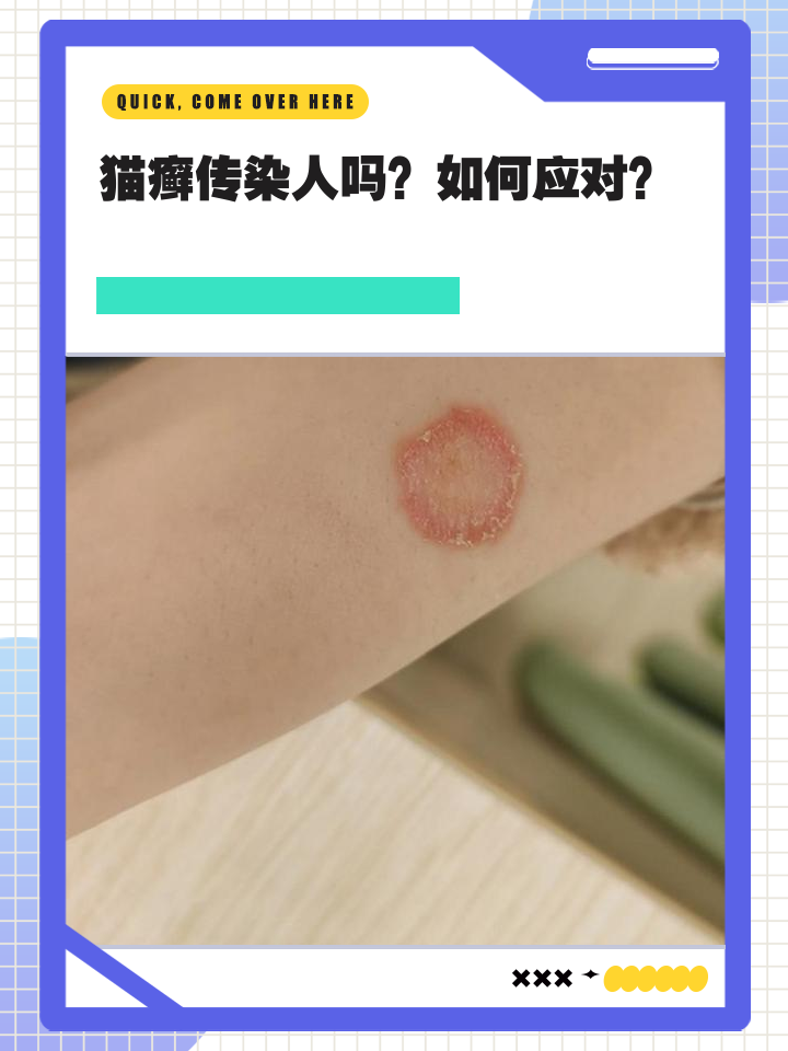 猫藓传染给人的几率是多大(猫藓传染给人的几率是多大啊)