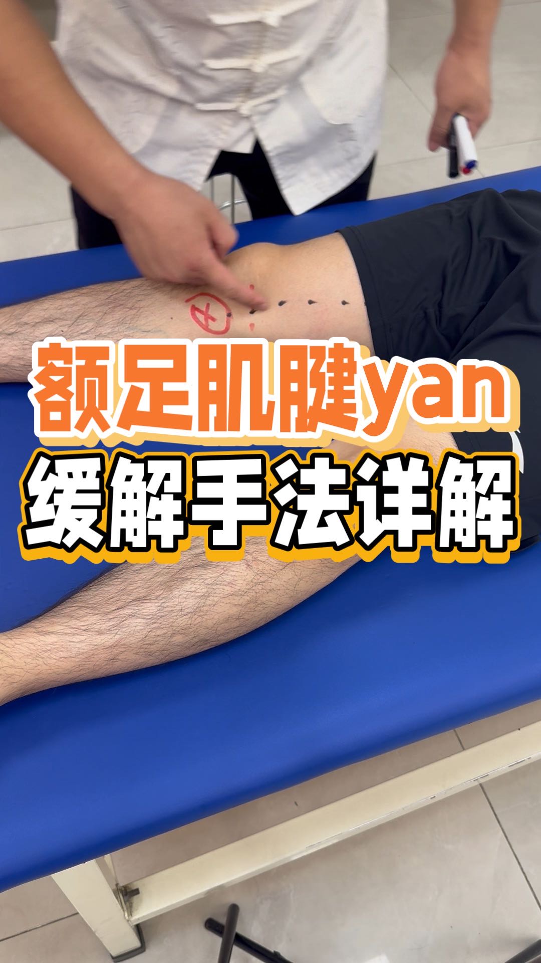 肌腱炎怎么治疗(冈上肌肌腱炎怎么治疗)