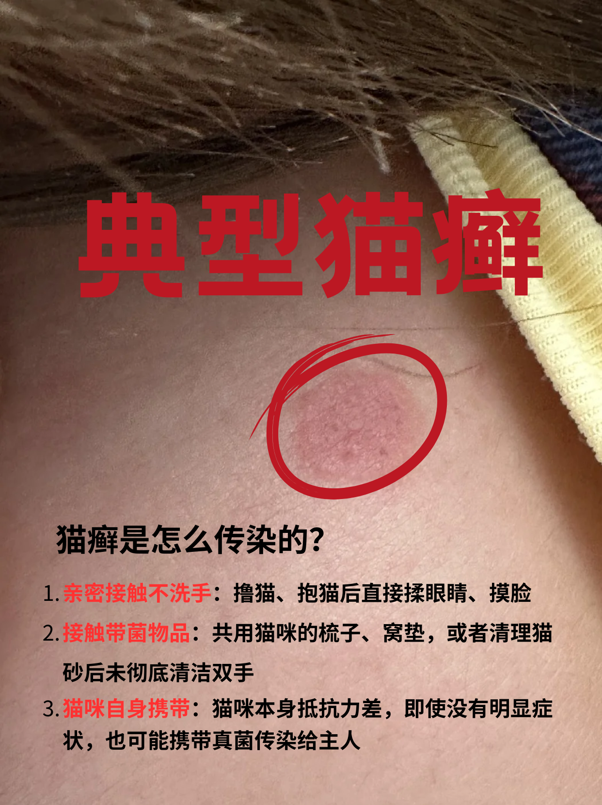 被猫咬了发病的前兆(被猫咬了发病的前兆是什么)
