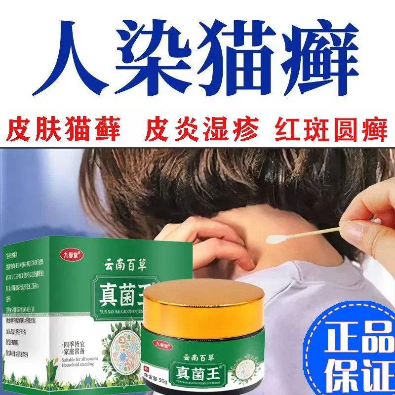 人被传染猫癣用什么药(人被传染了猫藓怎么办擦什么药膏)