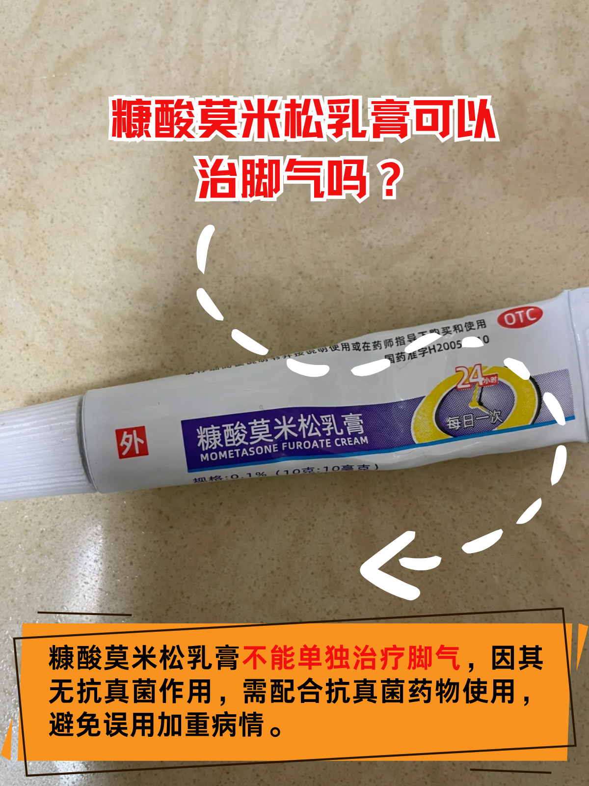 人得猫藓擦什么药膏(人得了猫藓买什么药膏)