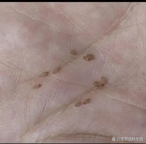 猫绦虫会传染给人吗(猫绦虫会传染给人吗 什么症状)