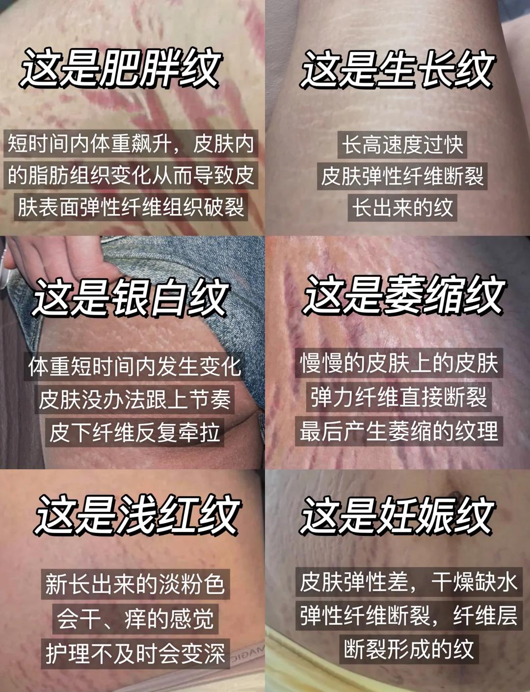 鱼骨纹和虎斑纹区别(鱼骨纹的虎斑值不值得买) 鱼骨纹和虎斑纹区别(鱼骨纹的虎斑值不值得买)