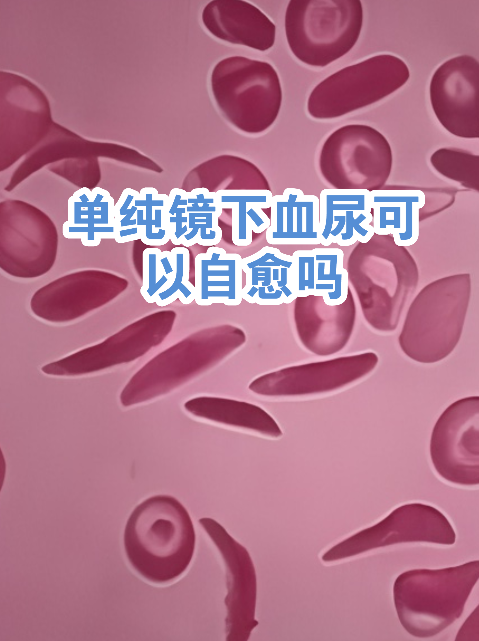 猫咪尿血能自愈吗(猫咪尿血能自愈吗公猫会死吗) 猫咪尿血能自愈吗(猫咪尿血能自愈吗公猫会死吗)