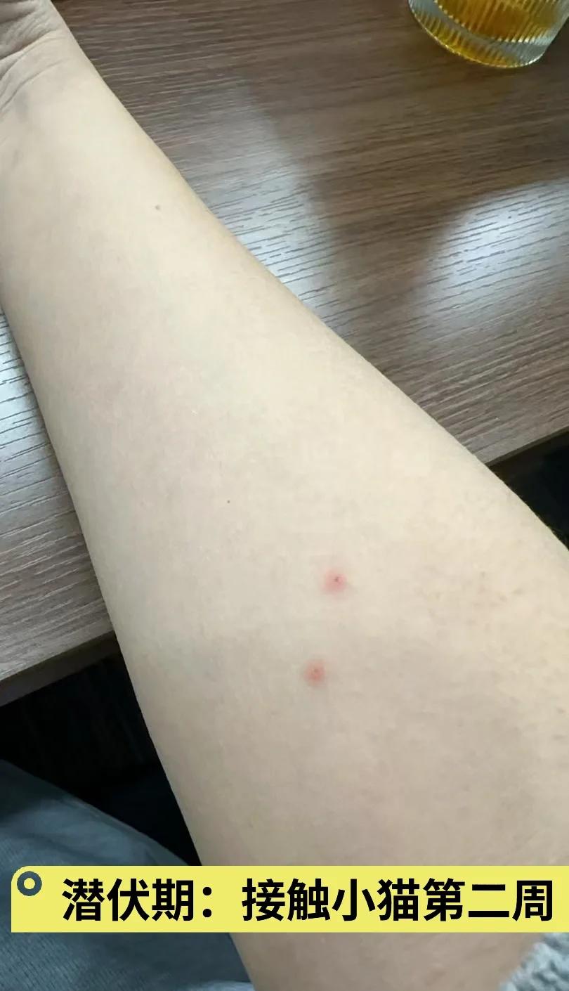 人得猫癣多久能好(人得了猫癣多长时间才能彻底好)