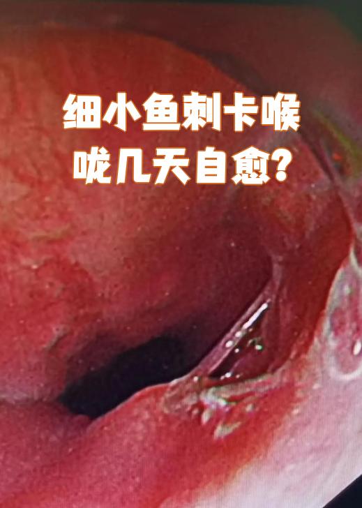 鱼刺的拼音(鱼刺的拼音是什么?)