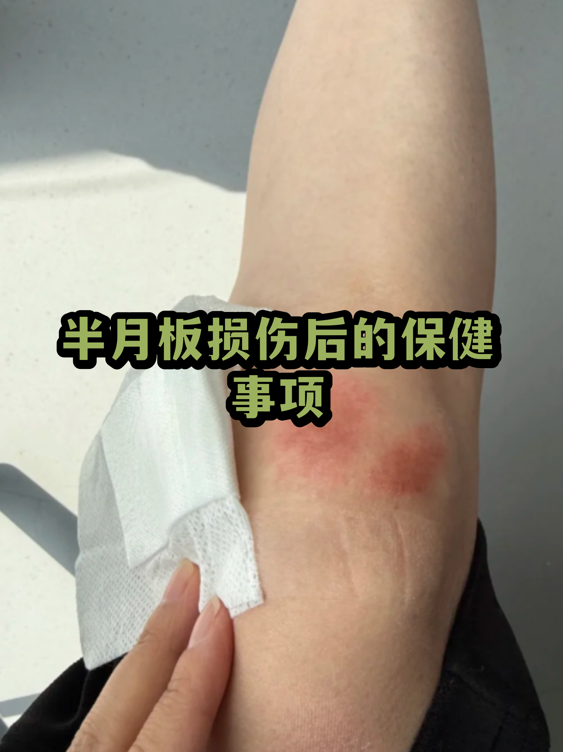 半月板二度损伤的最好治疗方法(半月板二度损伤能自愈吗多久能恢复)